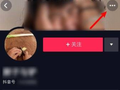 抖音聊天记录删除了还能查到吗第2步